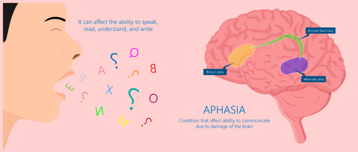 An Acquired Communication Disorder